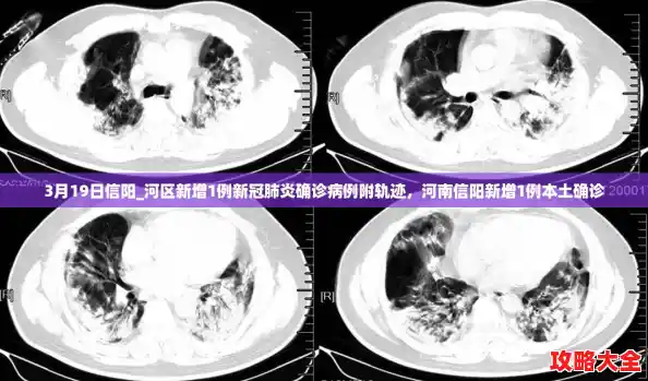 3月19日信阳_河区新增1例新冠肺炎确诊病例附轨迹，河南信阳新增1例本土确诊