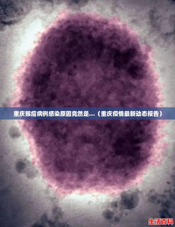 重庆猴痘病例感染原因竟然是...(重庆疫情最新动态报告) 重庆猴痘病例感染原因竟然是...(重庆疫情最新动态报告)