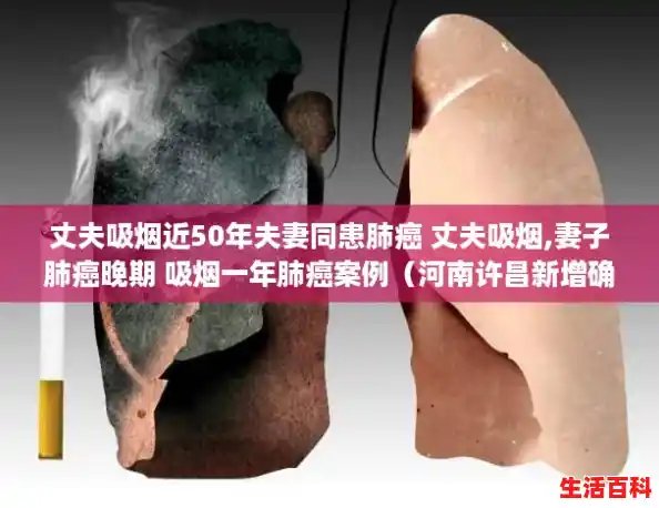 丈夫吸烟近50年夫妻同患肺癌 丈夫吸烟,妻子肺癌晚期 吸烟一年肺癌案例（河南许昌新增确诊病例）