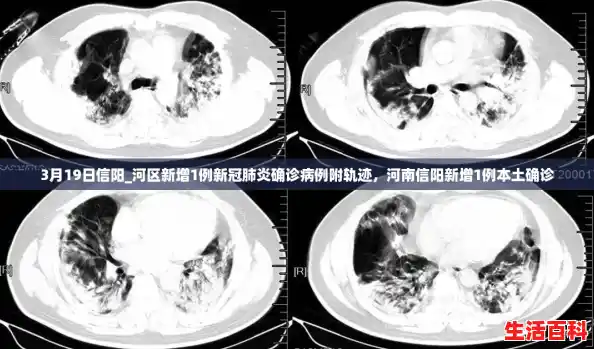 3月19日信阳_河区新增1例新冠肺炎确诊病例附轨迹，河南信阳新增1例本土确诊